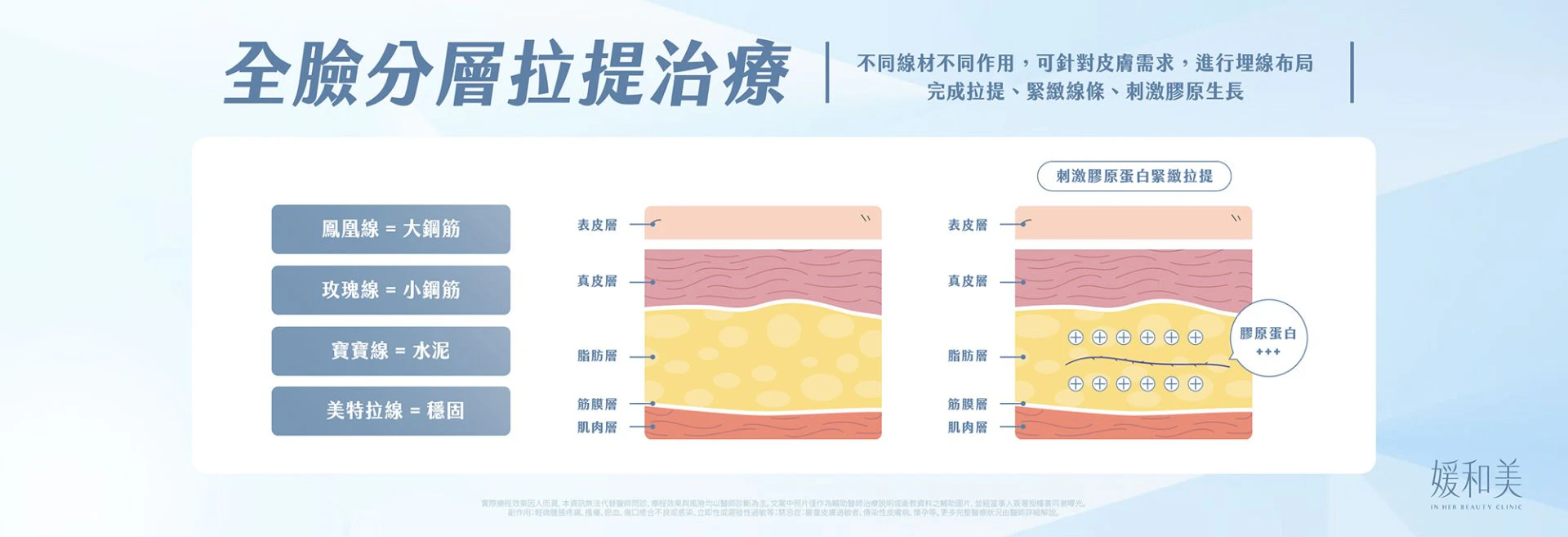 線材在軟組織層次提供有限度支撐的概念圖