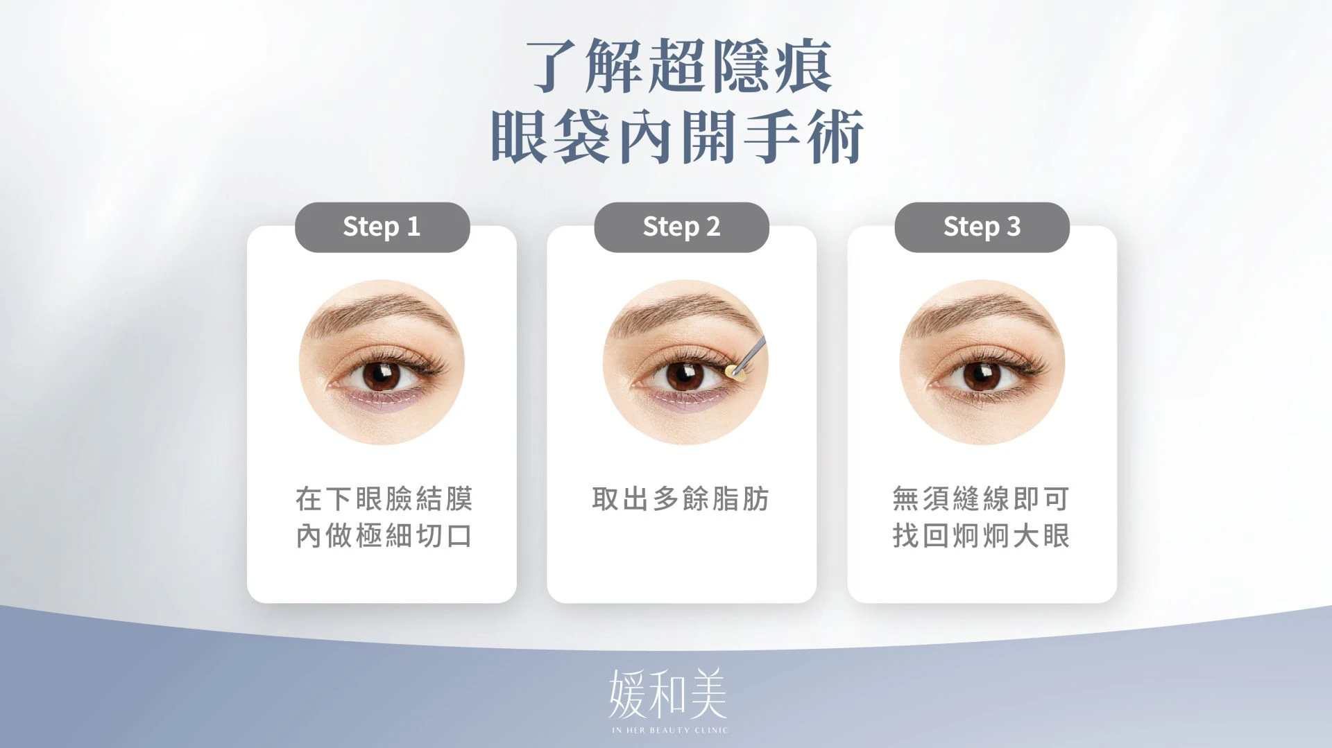 眼袋內開手術步驟說明圖