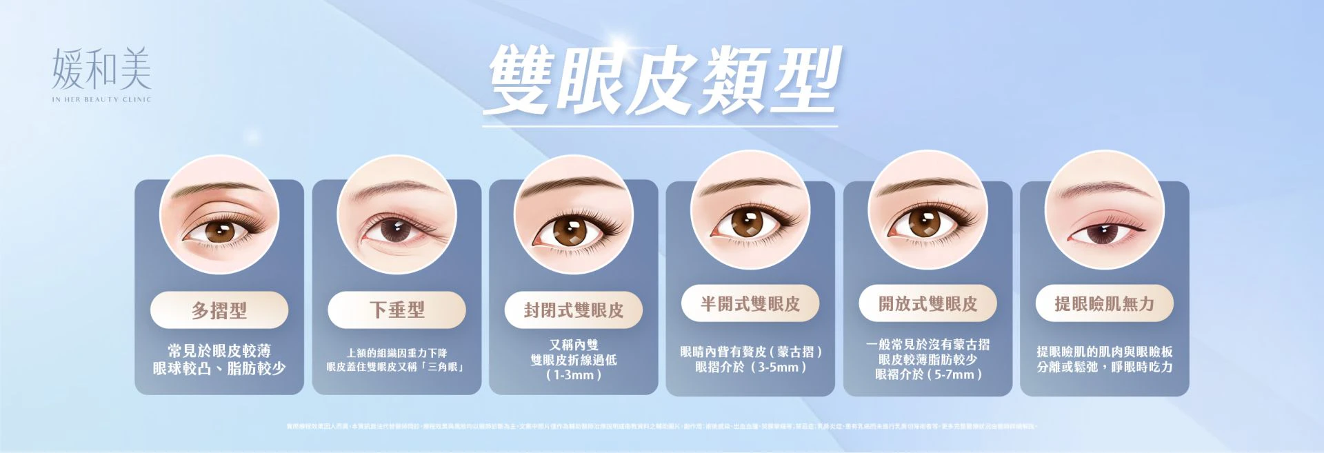 雙眼皮類型與眼部條件說明圖