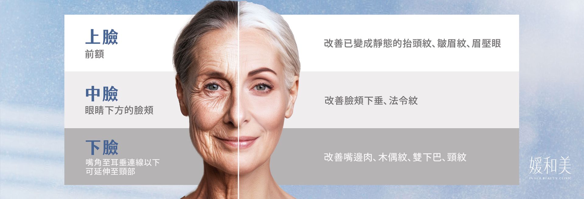 上臉、中臉與下臉評估區域說明圖