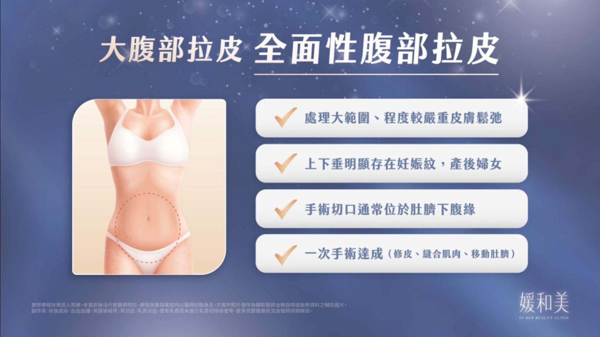 完整腹部拉皮的皮膚、腹壁與肚臍調整示意