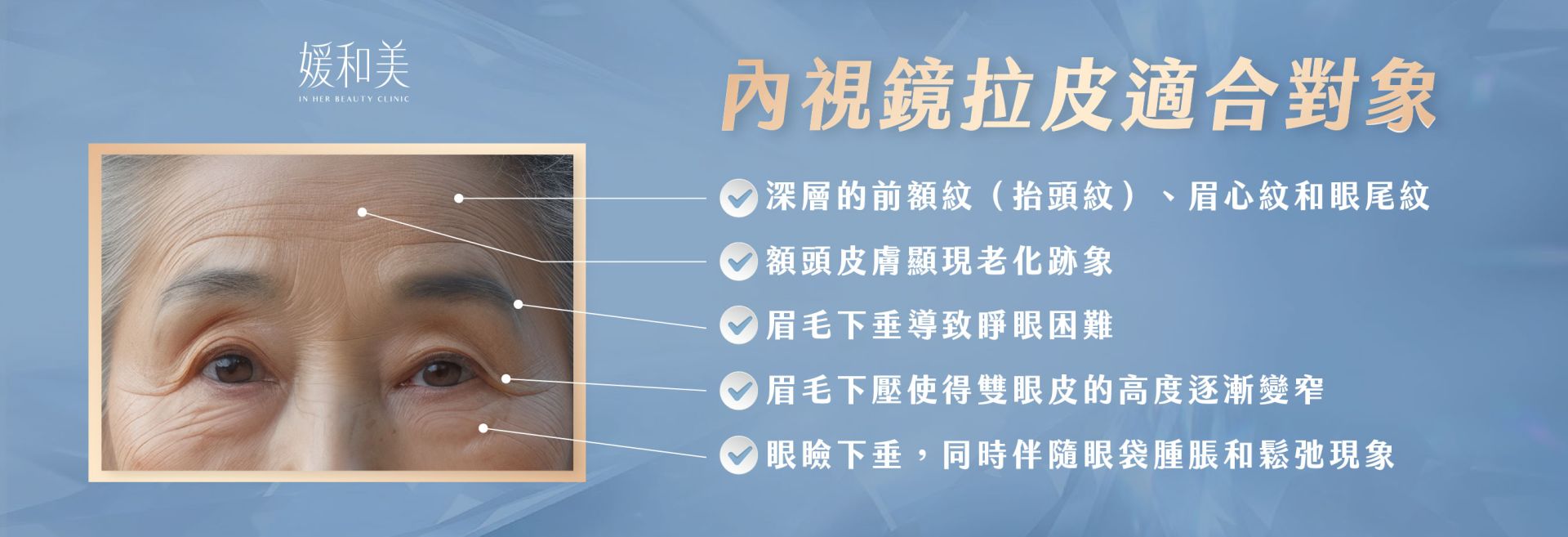 內視鏡前額拉皮適合評估對象
